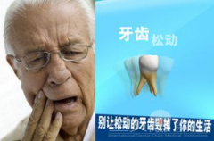 牙科知识：牙齿松动了怎么办