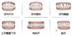 牙齿矫正多少钱