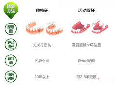 广州假牙多少钱一颗