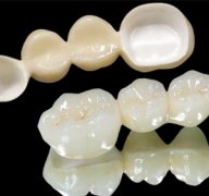 广州做全瓷牙哪家医院好