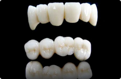 做全瓷牙多少钱