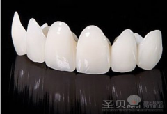 美容冠的修复过程