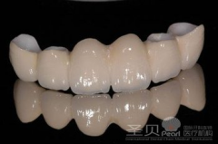 美容冠的材料选择