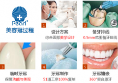 广州牙齿掉了一块怎么办