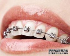 正畸一定要拔牙吗?