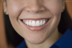 广州牙齿美容的方法有哪些？