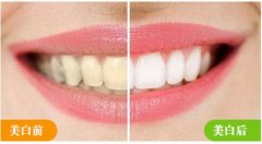 炫彩美白好不好