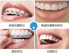牙齿矫正医院