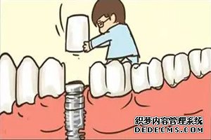 种植牙._副本.jpg