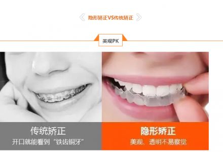 隐形矫正..jpg