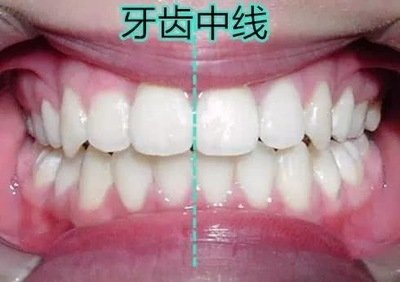 t014d06d26a3c0e02b8.jpg