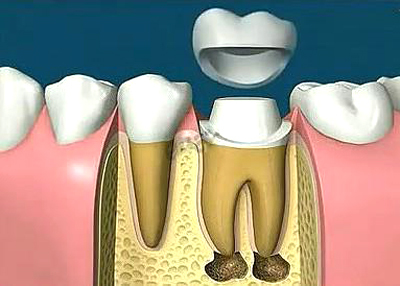 4-1G11313230E42.jpg