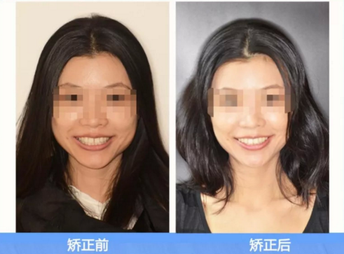 QQ截图20181128102956.png