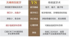 广州智齿要拔多少钱