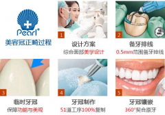 广州牙齿矫正费用